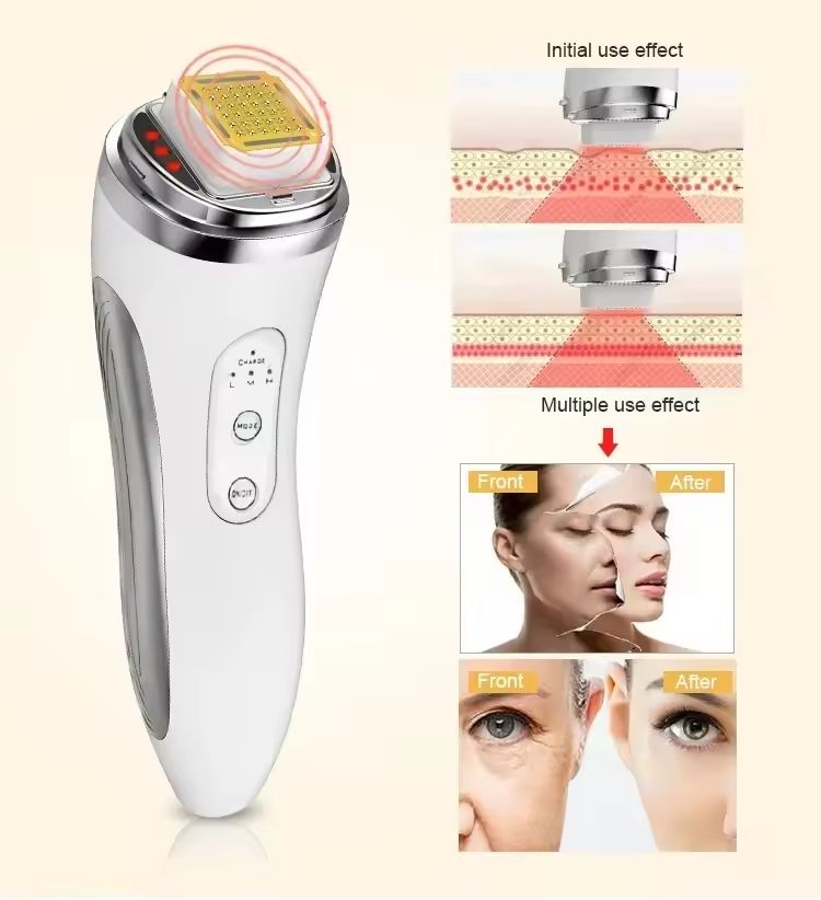 RF Radio Frequency Face Lifting Device Beauty Massager Wrinkle Remover 4