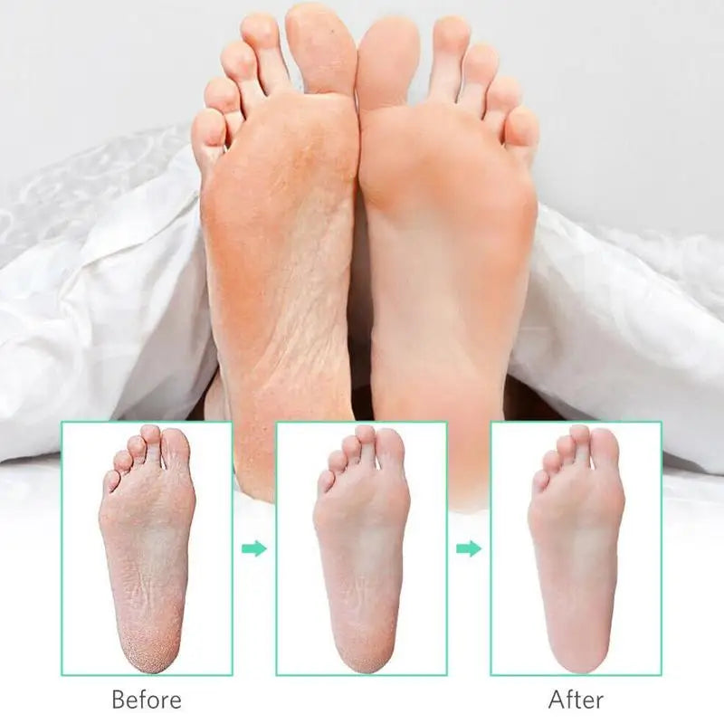 Stainless Steel Callus Corn Remover Foot Rasp, Hard Skin Heel File Scrubber, Pedicure Nail Care Tool for Smooth Feet