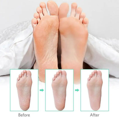 Stainless Steel Callus Corn Remover Foot Rasp, Hard Skin Heel File Scrubber, Pedicure Nail Care Tool for Smooth Feet