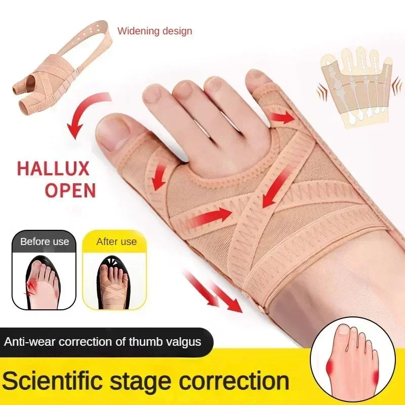 Fabric Bunion Corrector Breathable For Hallux Valgus Sleeve Spacer Separator Toe Corrector Easy To  1