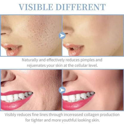 High Frequency Facial Machine 4 In 1 Portable Neon Wand For Acne And Skin Therapy 5