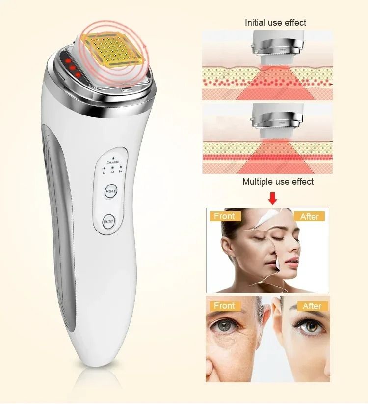 Radio Frequency Face Lifting Device Skin Tightening Wrinkle Remover Beauty Massager 4