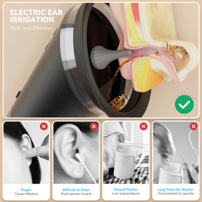 Professional Electric Ear Wax Removal System, Water Powered Irrigation Flusher with 3 Pressure Settings for Safe