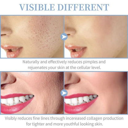 High Frequency Skin Therapy Wand Portable Handheld For Acne And Wrinkle Care 6