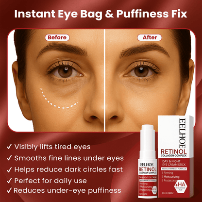 Instant Eye Bag Remove Eye Cream Korean Beauty Eye Care Fade Dark Circles Puffiness Lift Brighten A